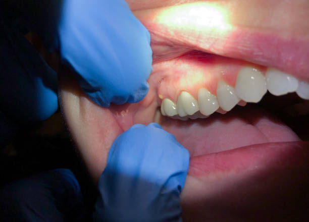 Best Pediatric Emergency Dentist in La Verkin, UT